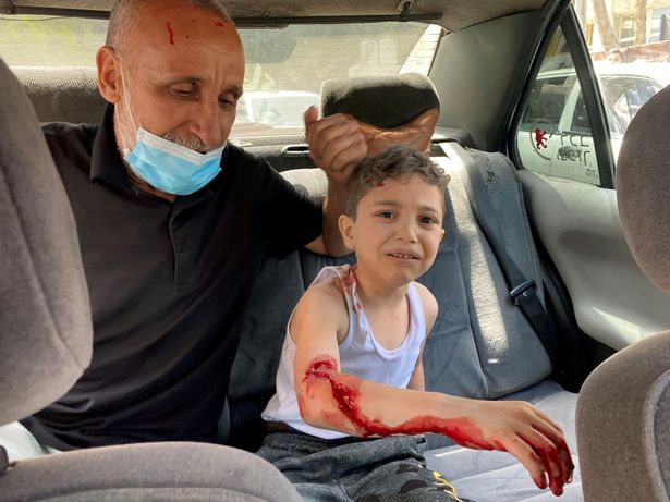 A wounded Palestinian boy is transported to hospital following an Israeli air strike