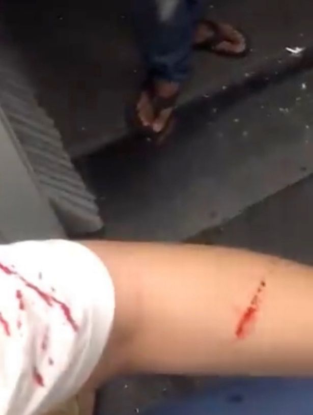 Passengers were left with cuts on their arms