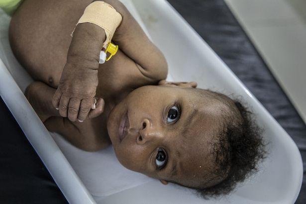 Noor aged just four months old and suffering from malnutrition