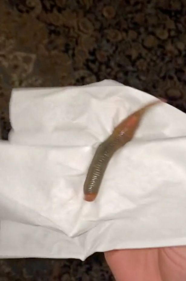 Zoe picked up the leech in a tissue after a friend flicked it from her leg