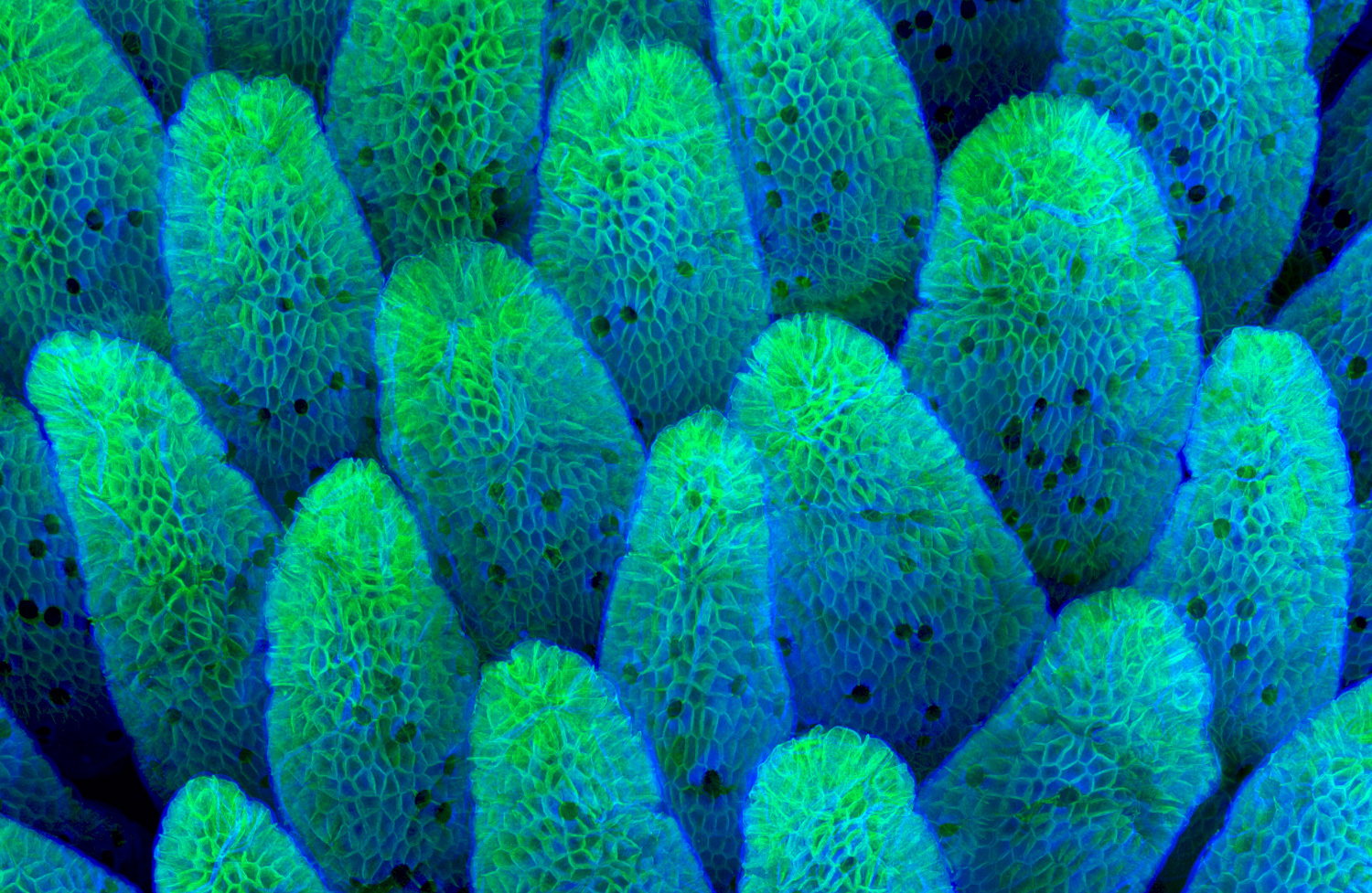 Villi from mouse intestine lining shown at 63 times magnification in blue and green