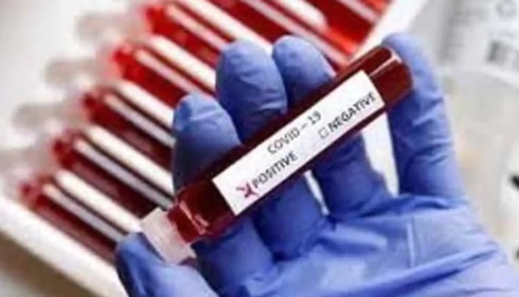 Bengaluru logs 887 Covid cases; health dept says positives include backlog cases | Bengaluru