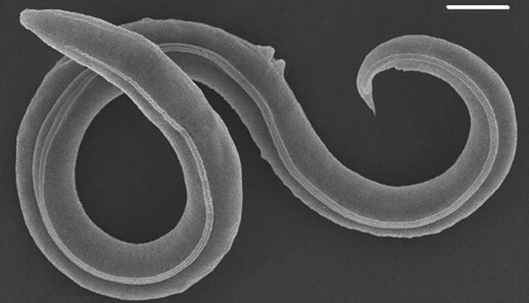 Weird Science | Wriggling worms and the state between life and death