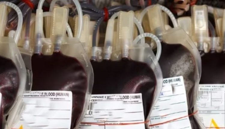 Thalassemia in Uttar Pradesh: 14 Children Undergoing Blood Transfusions at Kanpur Hospital Test Positive for Hepatitis, HIV