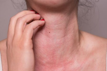 Are Allergies Making Your Summer Irritable? Know Tips To Deal With Allergens