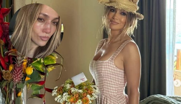 Jennifer Lopez Sustains Facial Injury During American Music Awards Rehearsals | People News