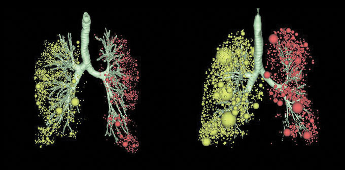 A 3-D image of two pairs of lungs
